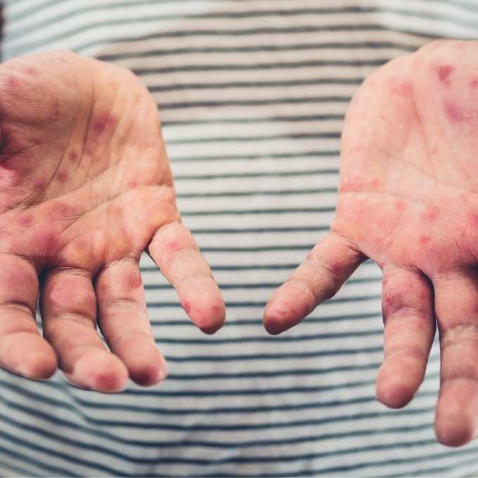 Infectious Disease Cleanup In Washington	Near Me Infectious Disease Cleanup In Washington	Near Me